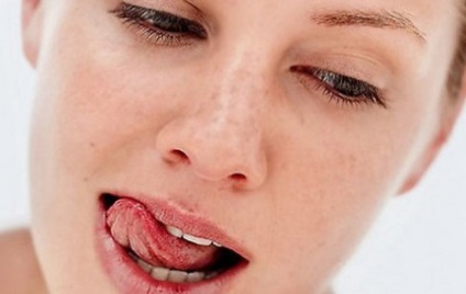 Condylomata în gura cauzează și tratamentul