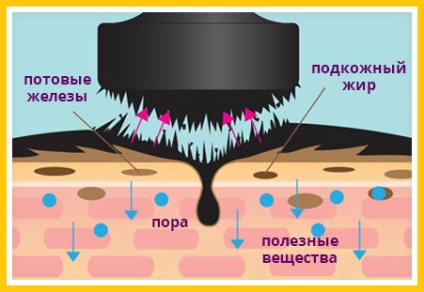 Mască magnetică - de pe acnee și pete negre