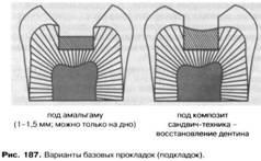 Materiale pentru garnituri de etanșare