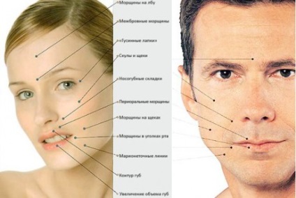 Mesoterápia arc - a hatás a mágia szélén megfizethető áron