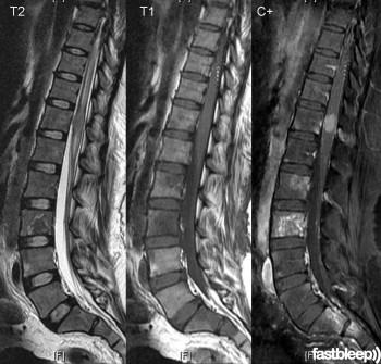 Diagnosticarea măduvei spinării - descrierea și adresele clinicilor