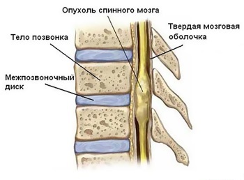 Diagnosticarea măduvei spinării - descrierea și adresele clinicilor