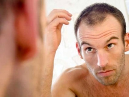 Alopecia în 20 de ani la bărbați cauzează, prevenirea și tratamentul