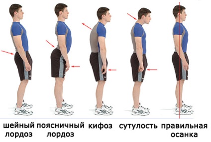 Testtartás gyakorlatok megerősítésére