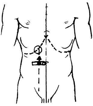 Percuție a ficatului și vezicii biliare, portal medical