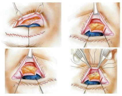 Chirurgie plastica in Thailanda - interesant despre Thailanda