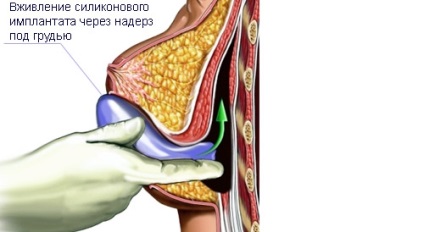 Chirurgie plastica in Thailanda - interesant despre Thailanda