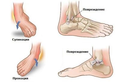 După rănire, compactarea pe picior a unguentului absorbit