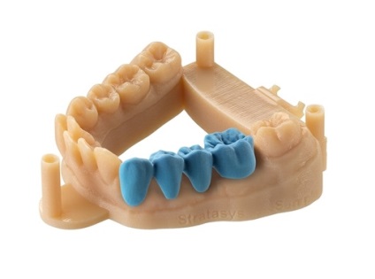 Aplicarea imprimării 3d în stomatologie - compania klona