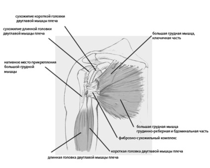 Nagy pectoralis izomtörés, fotók előtt és után, műtét, felülvizsgálat, kezelés, rehabilitáció és