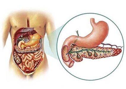 Ruperea și vânătaia simptomelor pancreatice, tratamentul, pancreatita