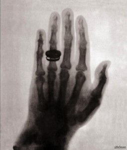 Astăzi marchează 170 de ani de la nașterea lui Wilhelm X-ray
