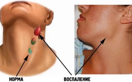 Rash la diferențele de bază orgi și cauzele apariției