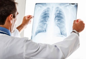 Stenoza codului arterei pulmonare cu μB 10 și cât de periculoasă este