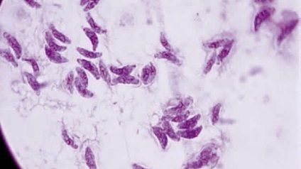 Toxoplasmoza gondii care este un astfel de simptom și tratament, o fotografie a unui parazit