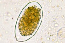 Trichostrongiloidoza - helmintiazele intestinale