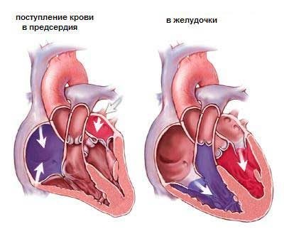 Simptomele contuziei cardiace, cauze, tipuri