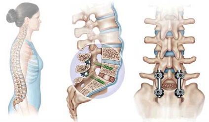 Îngrijirea pacienților cu leziuni ale coloanei vertebrale, măduvei spinării, pelvisului