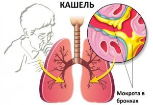 A köhögés, a besorolás és a kezelés típusai gyermekeknél és felnőtteknél