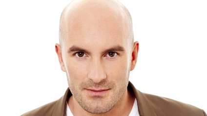 Alopecia la bărbați, focală, difuză, seboreică, principii de tratament