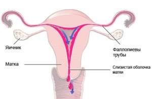 Tipuri dureroase de menstruație, simptome, cauze, tratament, prevenire