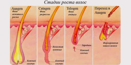 Alopecia difuză la femei și bărbați cauzează și tratamentul căderii părului