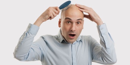 A hajhullás okozta diffúz alopecia a nők és férfiak körében