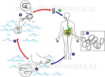 Dracunculioza, simptome și tratament