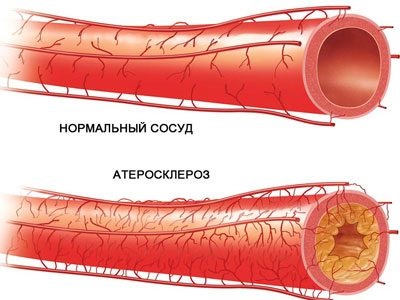 Drotaverina si alcoolul va ajuta daca nu-shpa cu mahmureala