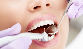 Inovații în tratamentul dinților