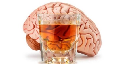 Cum alcoolul ne distruge creierul de ce ne îmbatăm sub o lampă!