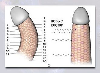 Hogyan lehet megnyitni a pénisz szélességét?