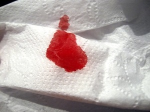 Eroziunea sângerării colului uterin poate sângera, de ce începe să se vindece, este periculoasă și