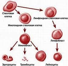 Tratamentul leucemiei - transplant de celule stem