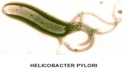 Tratamentul tratamentului cu Helicobacter pylori