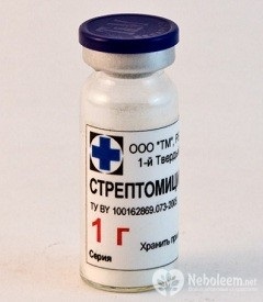 Limfadenită - cauze, simptome, tipuri, diagnostic, tratament, prevenire