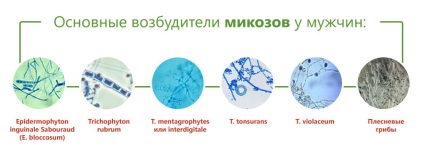 Мікоз у чоловіків в паху, лікування пахового дерматомікози у чоловіків, препарати, фото