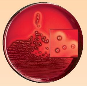 Microbio staphylococcus aureus (mikrobiológia - kutatási tárgyak - élelmiszer, takarmány,