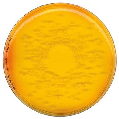 Microbio staphylococcus aureus (microbiologie - obiecte de cercetare - produse alimentare, hrană pentru animale,