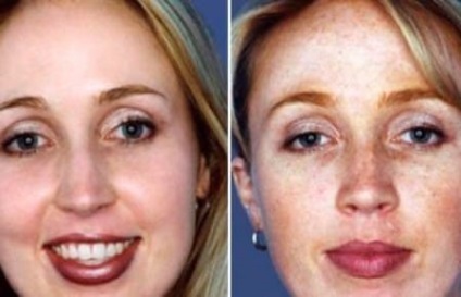 Peeling Almond Face отзывы, fotografie înainte și după