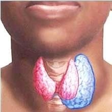 Glanda tiroidă se umflă