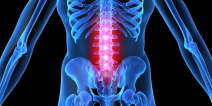 Osteochondroza de 1 grad de lombar, cervical și toracic