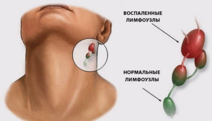 Otita urechilor (fotografie)