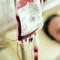 Transfuzia de sânge (autohemoterapie)