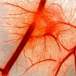 Semne, cauze și tratamentul distoniei vegetative-vasculare
