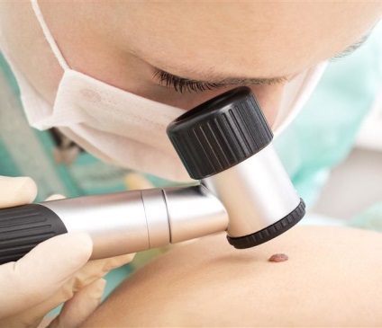 Profesorul de dermatologie avertizează cu privire la creșterea cancerului de piele în Dnipro! Niprul