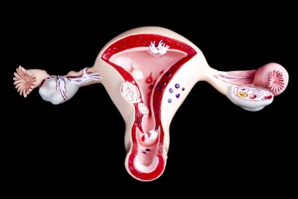 Ruptura chistului ovarian de ce se întâmplă și cât de periculoasă