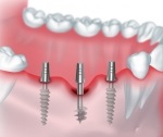 Clinica stomatologică exemplul clinicii dentare a tratamentului modern