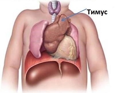 Timomegalya a gyermekekben, mi az, és hogy szükséges-e harcolni