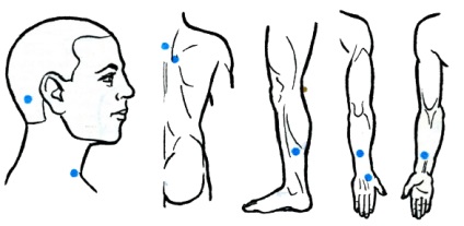 Acuprese cu hipertensiune arterială ca una dintre metodele de terapie generală